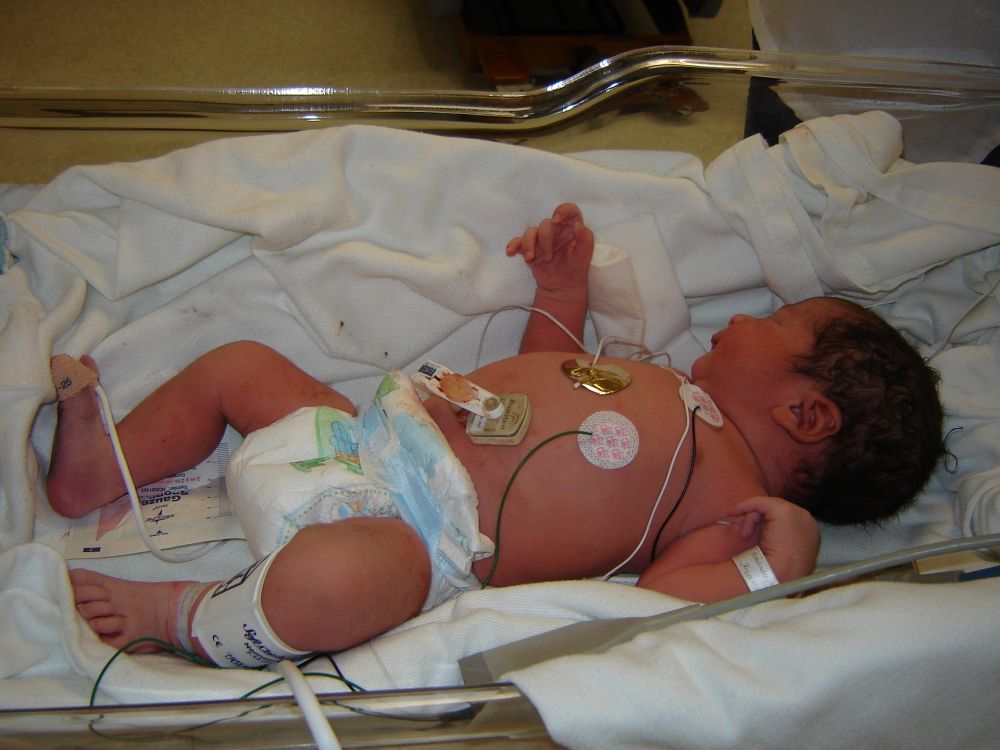 a newborn in hospital